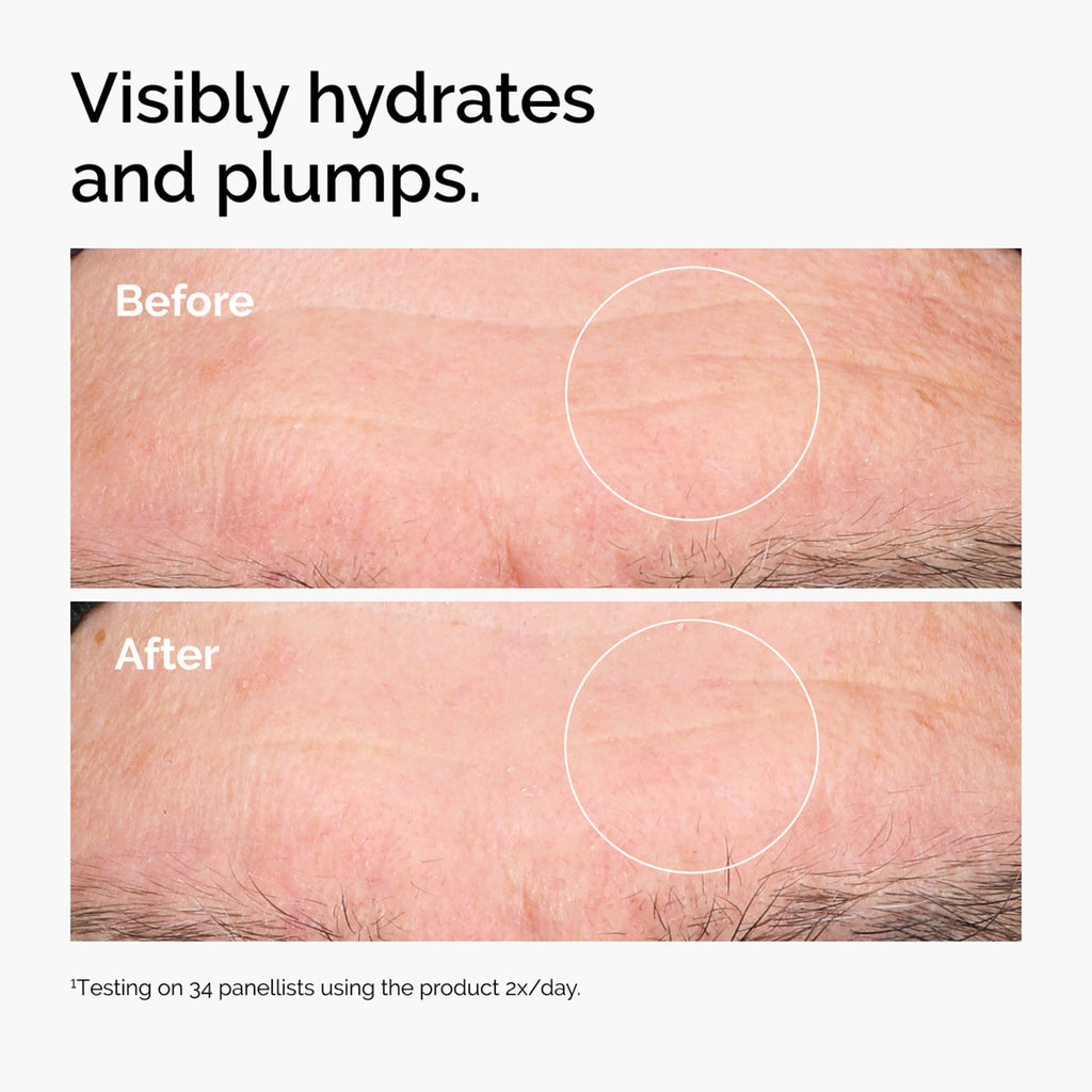 The Ordinary Hyaluronic Acid 2% + B5 - vue 5